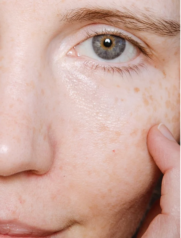 Close-up of a woman's face showcasing healthy skin texture after using Peptide Anti-Aging Serum for All skincare.