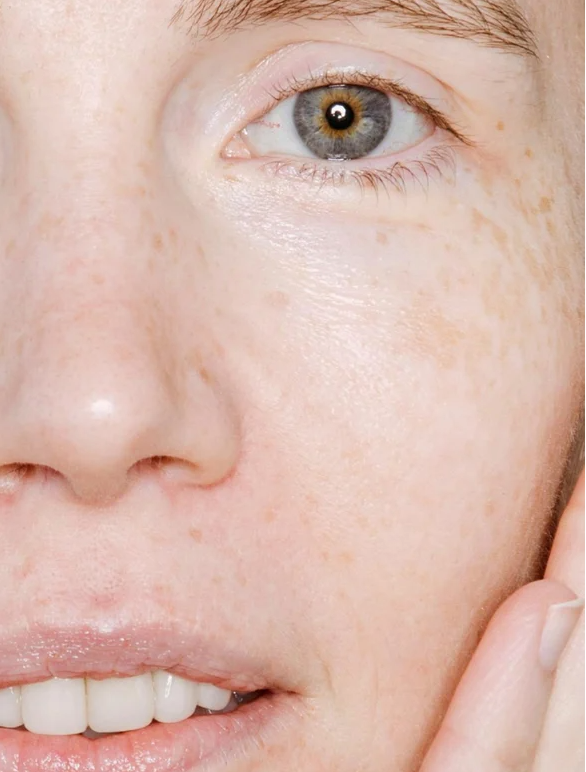 Close-up of a person's face with healthy skin, showcasing the benefits of Radiant Glow Facial Wash For All Skin Types.