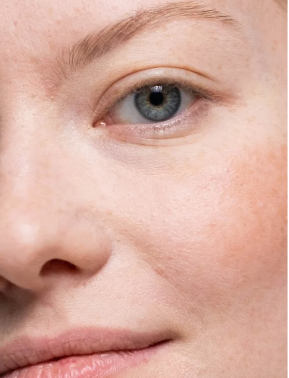 Close-up of youthful skin showing natural glow, ideal for promoting Youthful Glow Serum For All Skin Types.