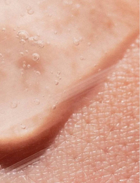 AHA Peeling Concentrate For Skin applied on textured skin, showing the exfoliating product's smooth consistency.