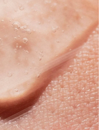 AHA Peeling Concentrate For Skin applied on textured skin, showing the exfoliating product's smooth consistency.